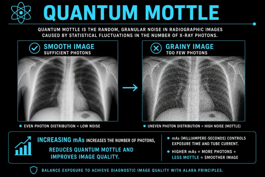 Side-by-side smooth chest image and grainy quantum mottle image